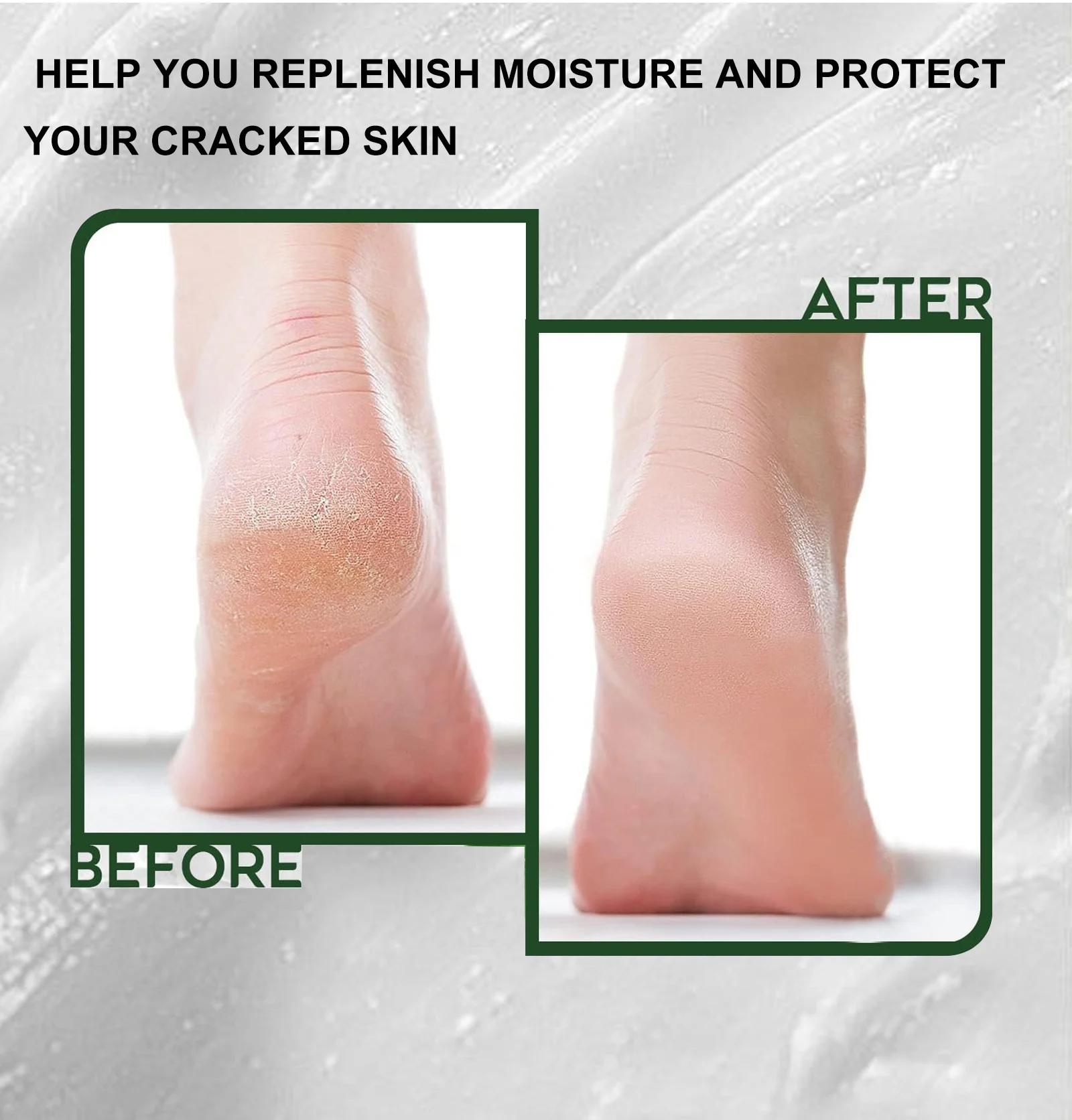 urea foot cream spu842160943669 desc 8