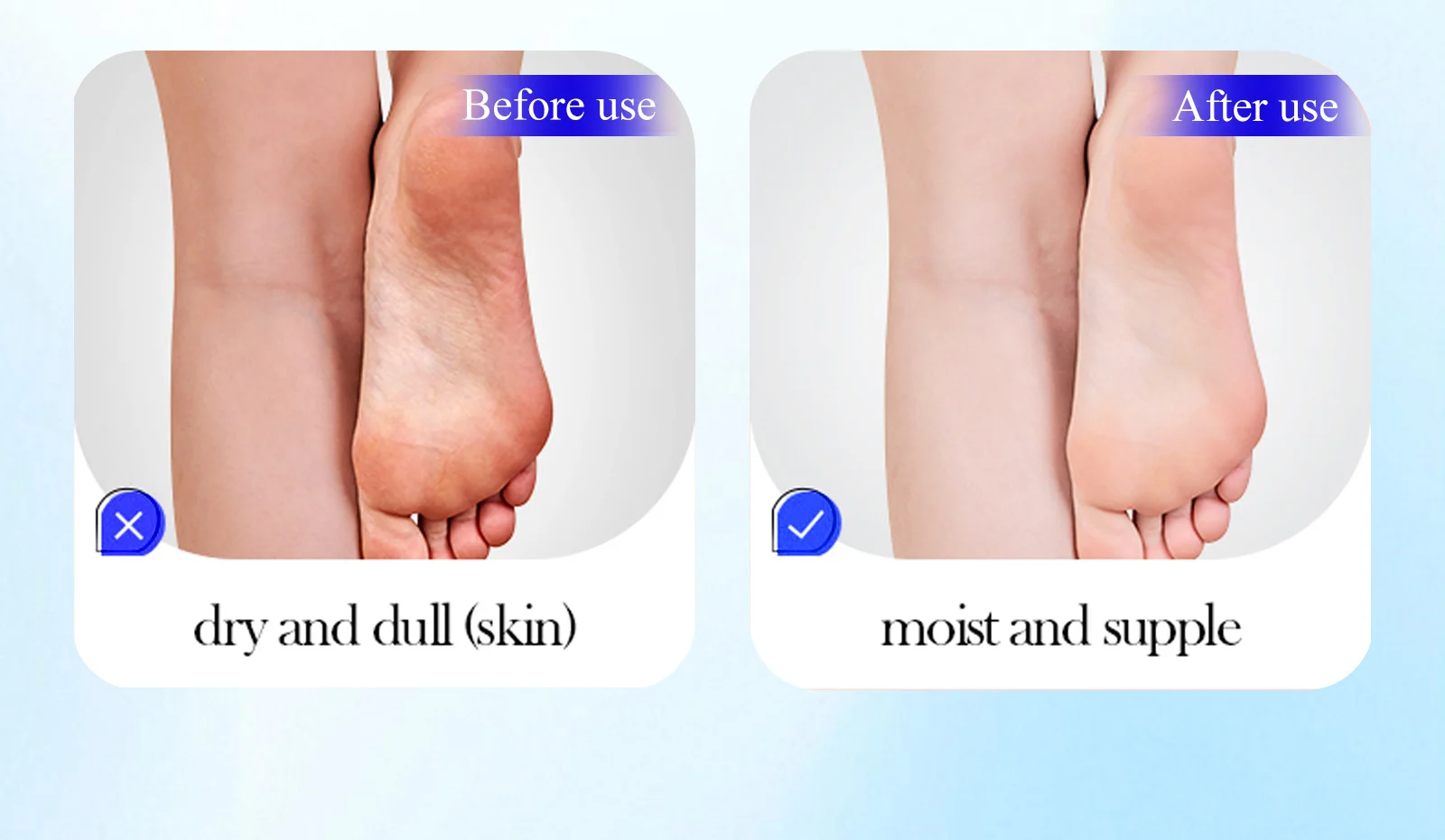 YURHERSU 40% Urea Cream with 2% Salicylic Acid - Intensive Foot Moisturizer for Cracked Heels & Calluses 7 urea foot cream spu959243816740 desc 8