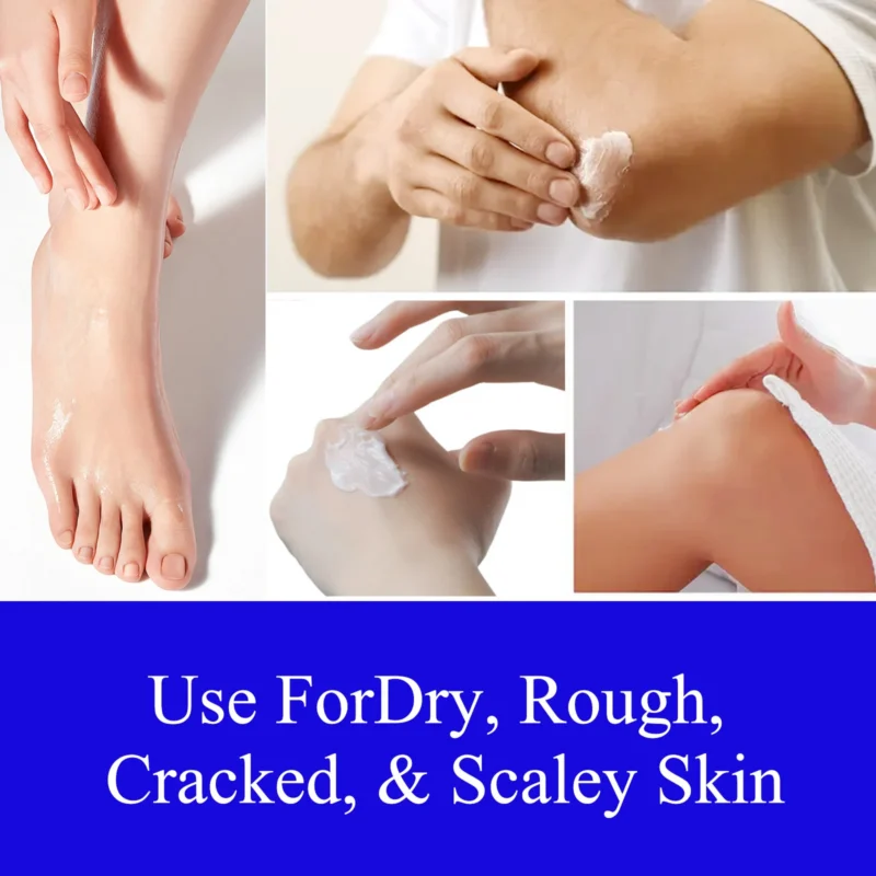 Urea Foot Hand Cream Spu725580581641 3