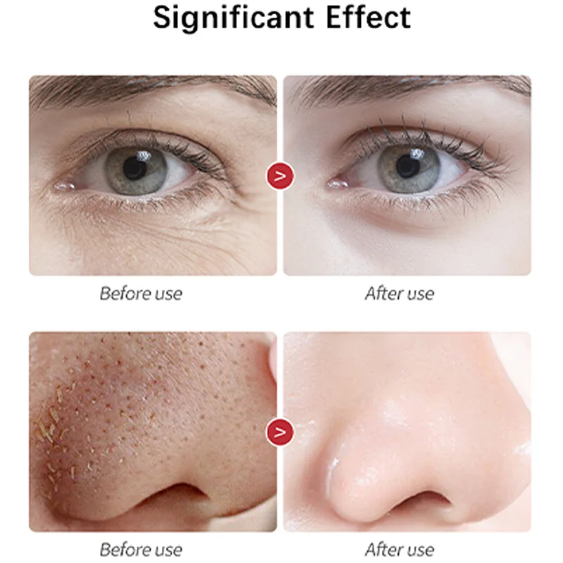 vitamin c hyaluronic acid serum spu723309431656 desc 10